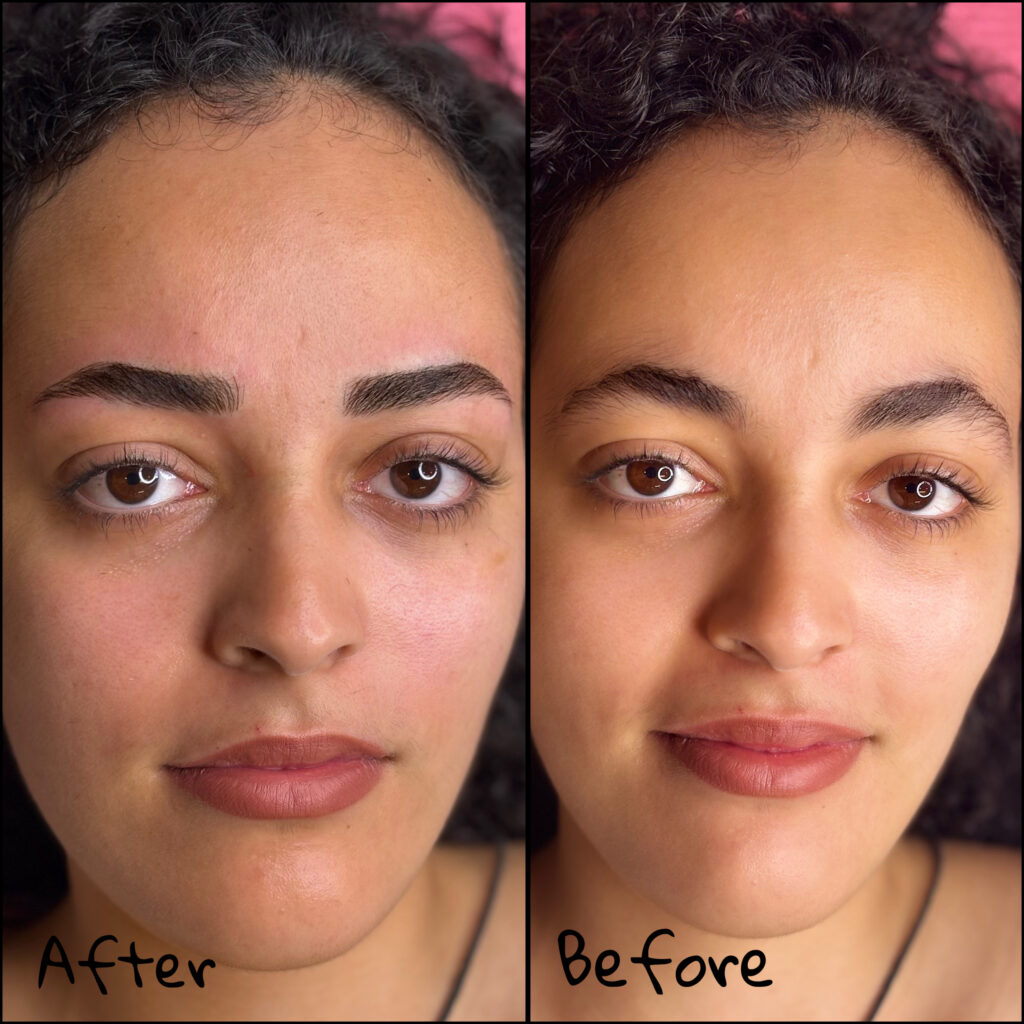 microblading-for-sparse-eyebrows-before-after.jpg Microblading for sparse eyebrows before and after
